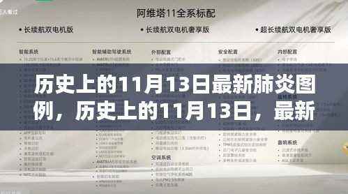 历史上的11月13日,最新肺炎图例深度解析与回顾