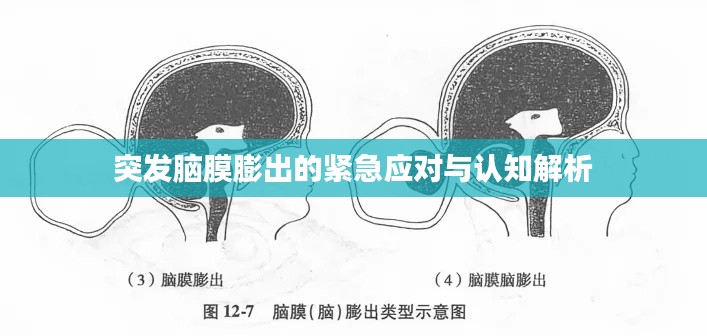 突发脑膜膨出的紧急应对与认知解析