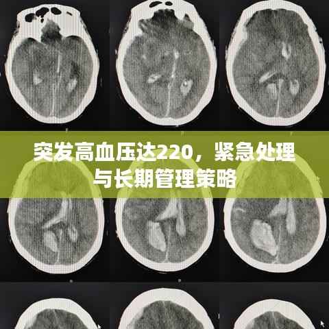 突发高血压达220,紧急处理与长期管理策略