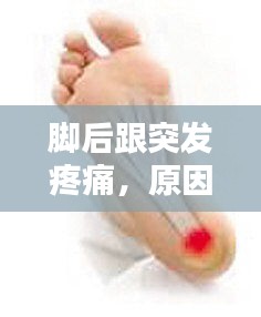 脚后跟突发疼痛,原因解析、诊断指南与治疗方案